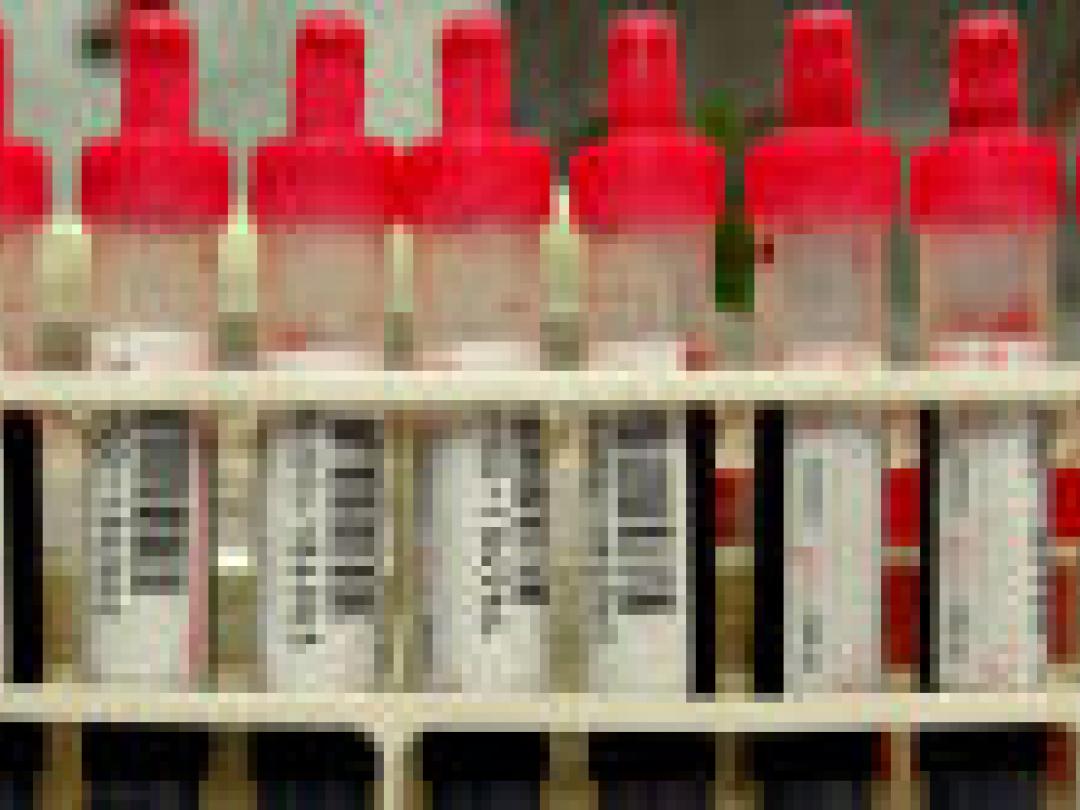 Nieuwe review bevestigt: PSA screening niet zinvol