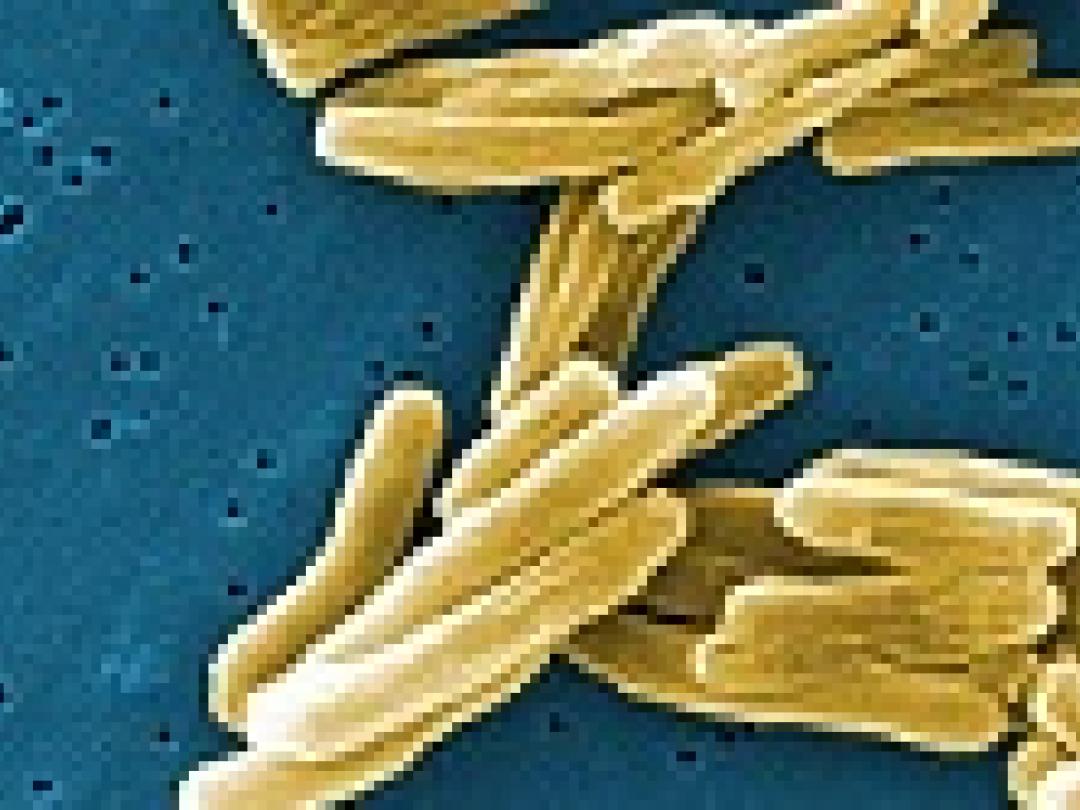 Nieuwe sneltest tuberculose lijkt kosteneffectief