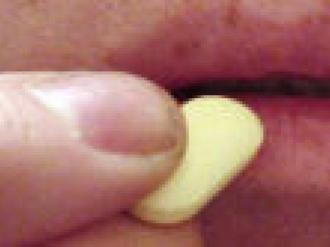 Hepatitis C-behandeling met tabletten: het kan!