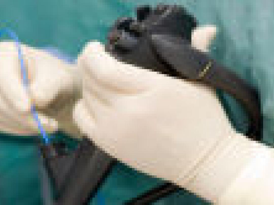 Minimaal invasieve slokdarmoperatie op korte termijn beter