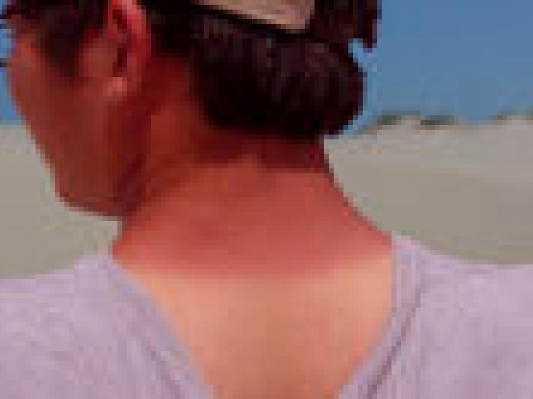 Kinderen op reis vaker ziek dan ouders