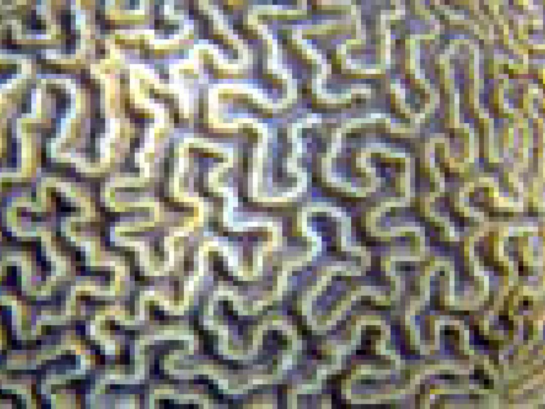 Operatie hersentumor beter met ‘mapping’