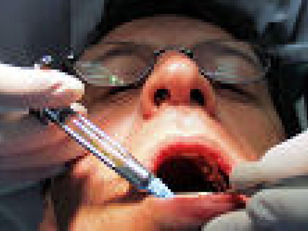Infectierisico bij tandartsen niet gering