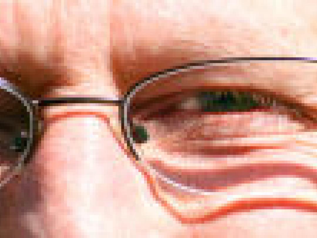 Lager risico op gebroken heup na staaroperatie