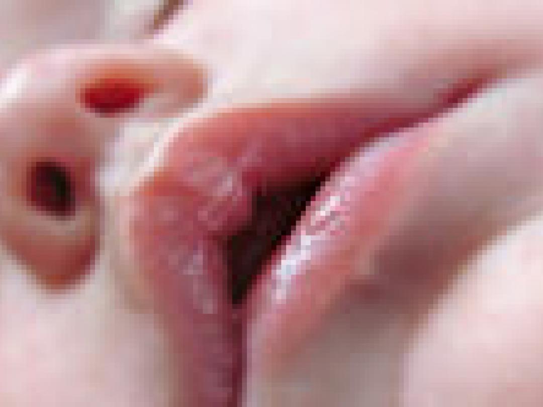 Dikste peutertjes hebben ‘s nachts minder lucht