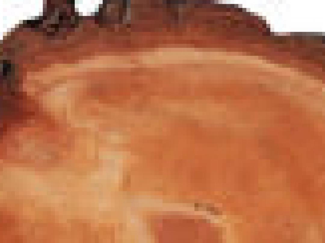 CT-scan en risico op kanker