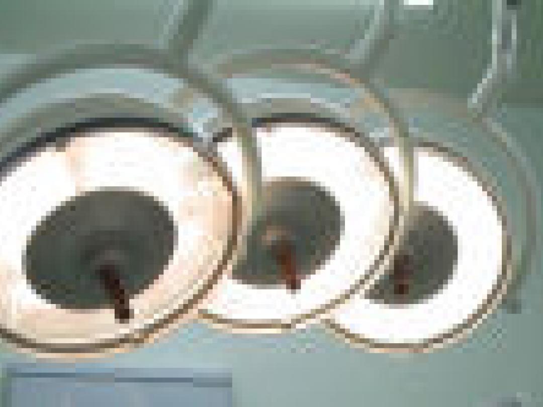 Verschillen in veiligheid van maagoperatietechnieken