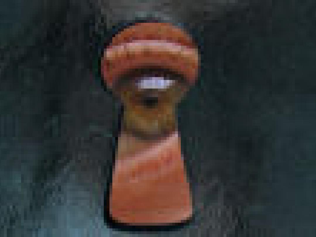 Locked-insyndroom zeldzaam in verpleeghuizen