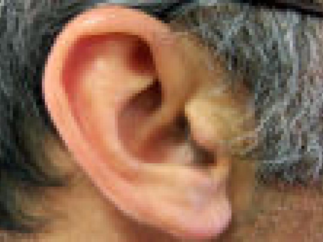 Bespoedigt gehoorverlies cognitieve achteruitgang?