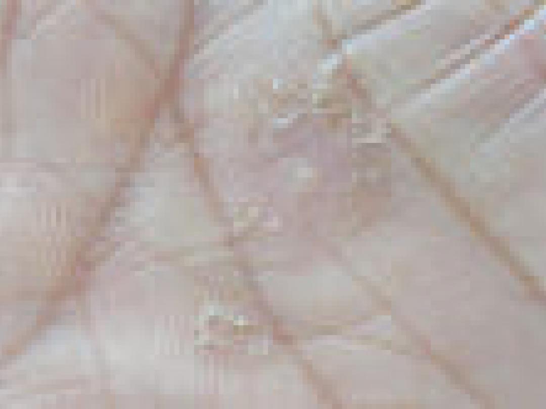 Stijging prevalentie psoriasis in Noorwegen