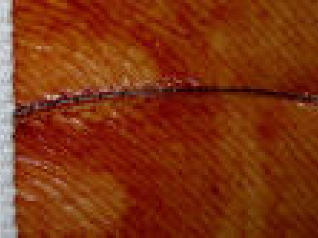 Ruggenprik vaker succesvol door echo