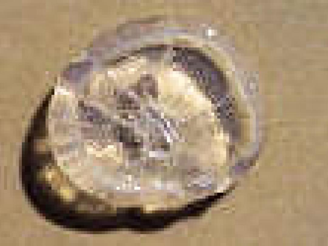 Slechter af bij borstkanker na borstvergroting?