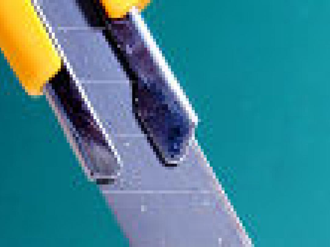 Zaagmal voegt weinig toe bij knieoperatie