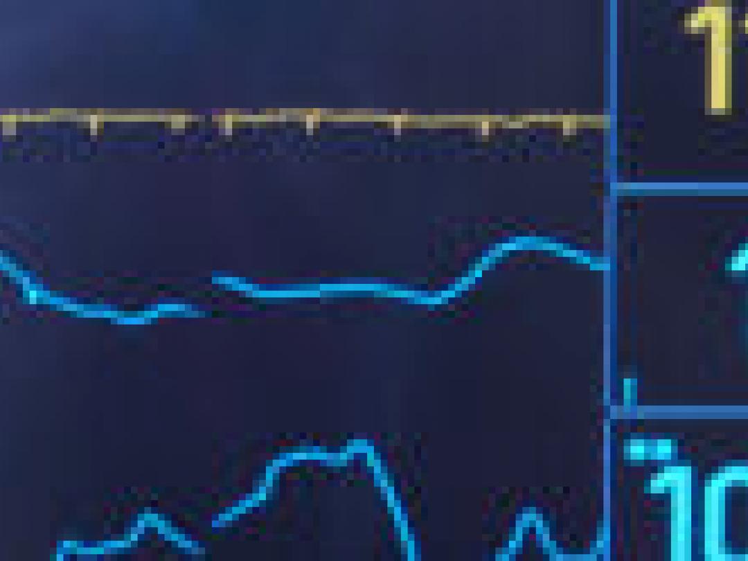 Gerichte feedback en verbeterteams leiden niet tot betere uitkomsten op de IC