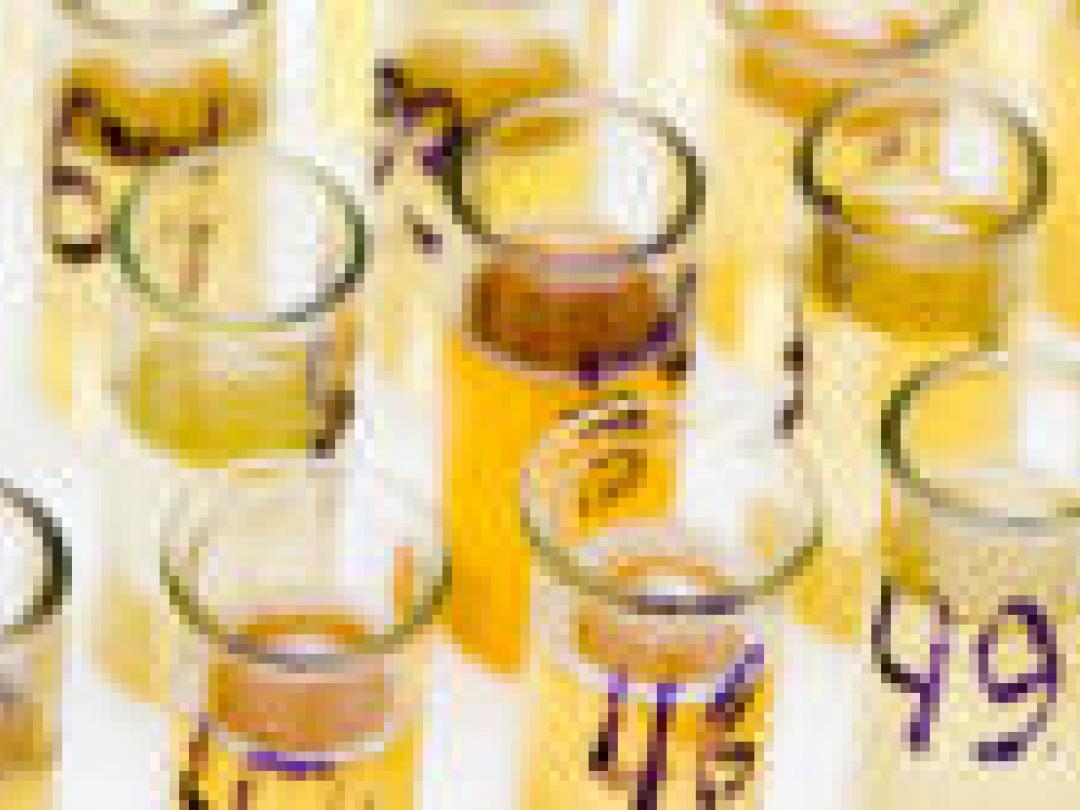 Geen invloed urinezuurmetabolisme op hartziekte