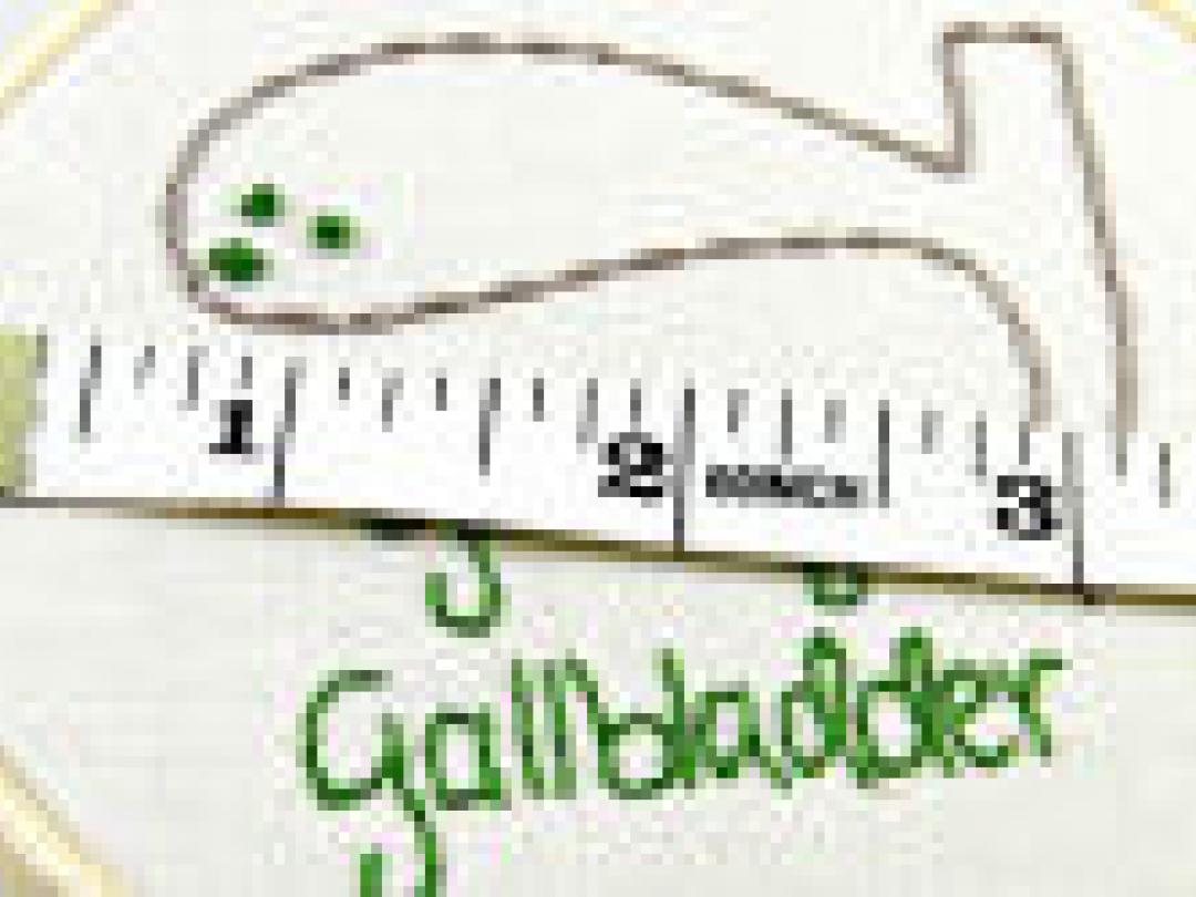 Routine-PA galblaas wellicht overbodig