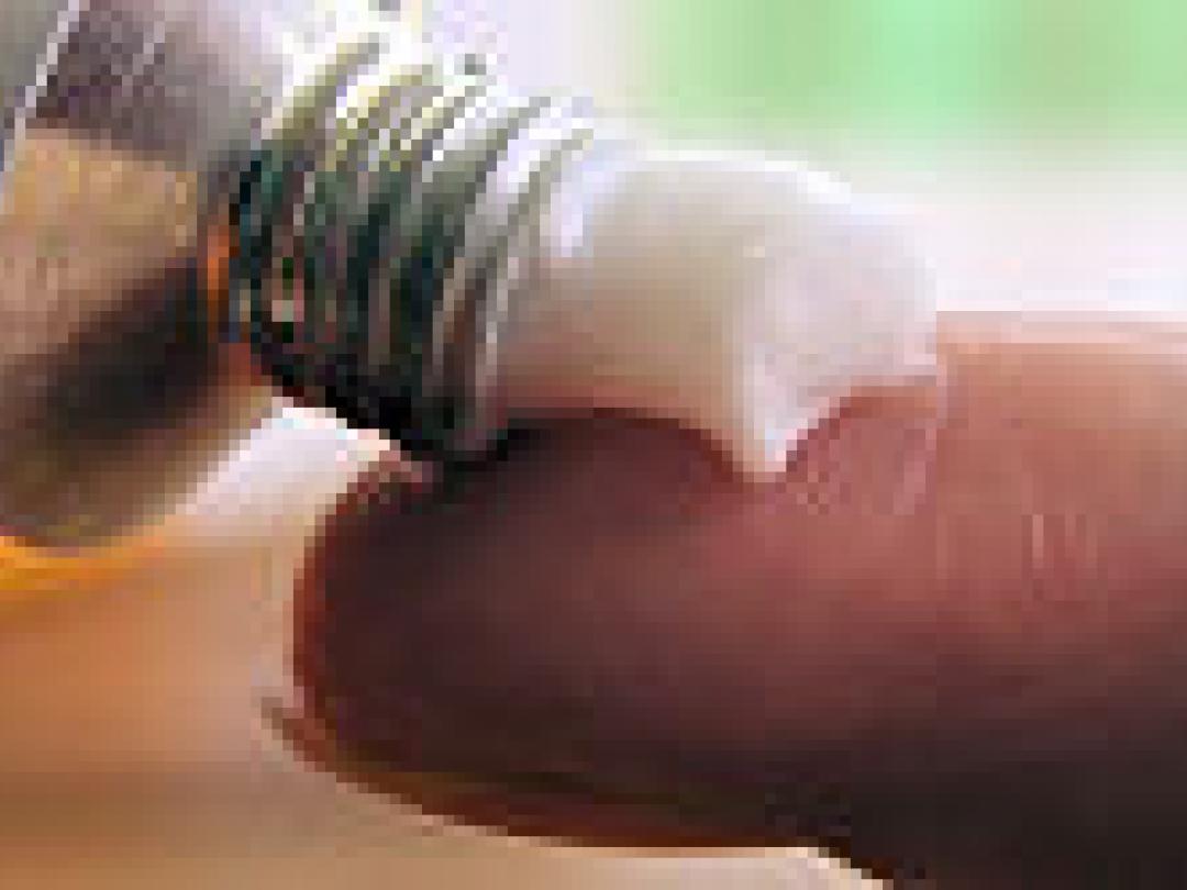 Glucocorticoïdcrème vermindert bestralingsdermatitis