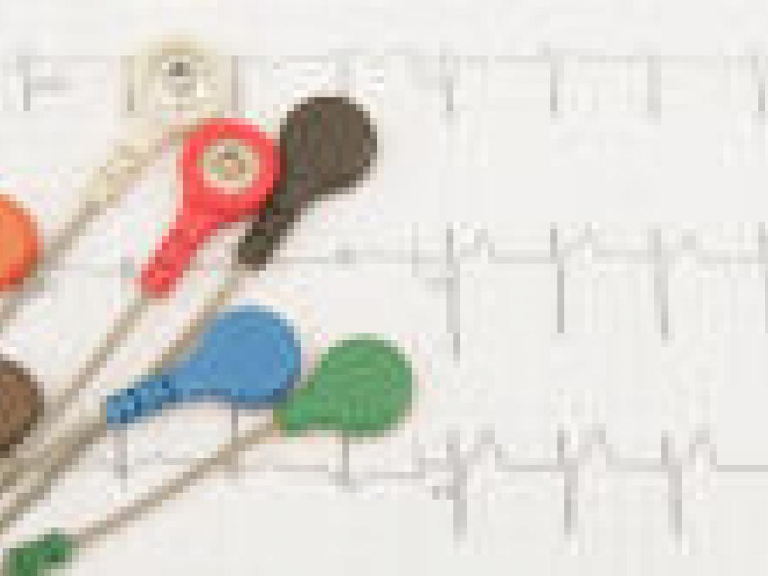 Echo hart geen goed screeningsinstrument