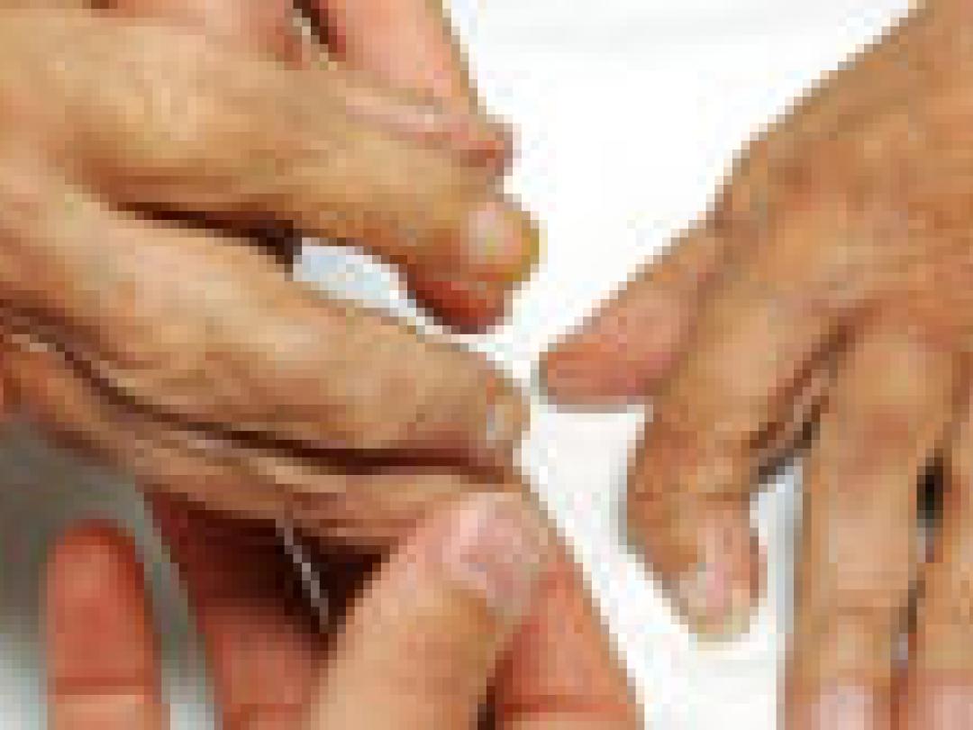 ‘Nog plek voor multidisciplinaire aanpak reumatoïde artritis’