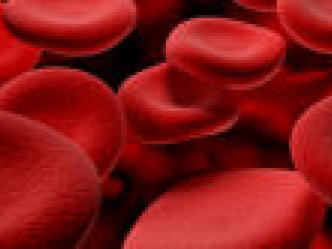 Sepsisrichtlijnen verminderen sterfte