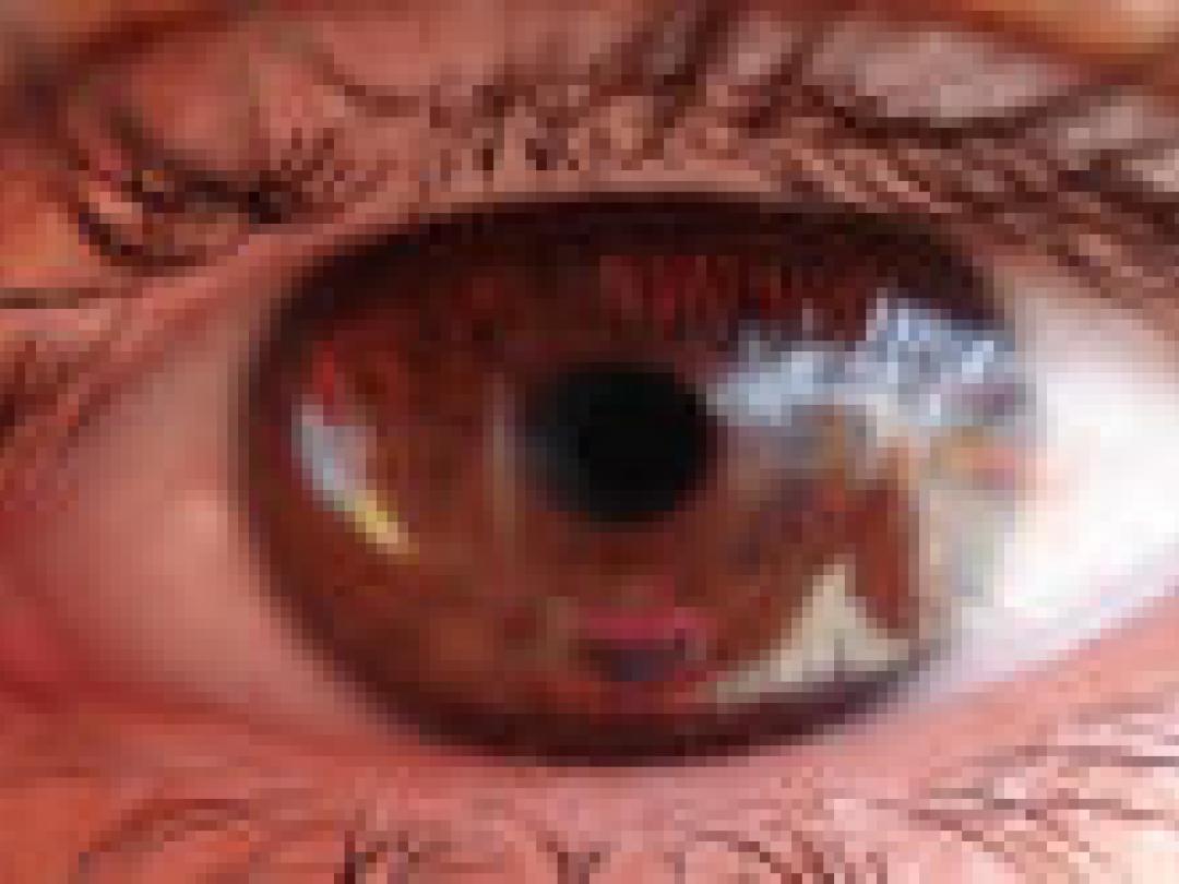 Klachten van droge ogen hangen samen met lage pijndrempel