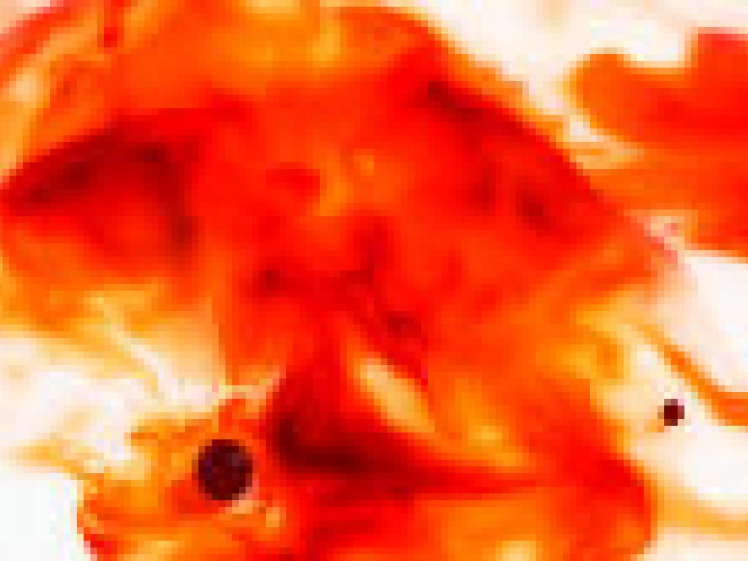 Ook jaren na een SAB nog PTSS