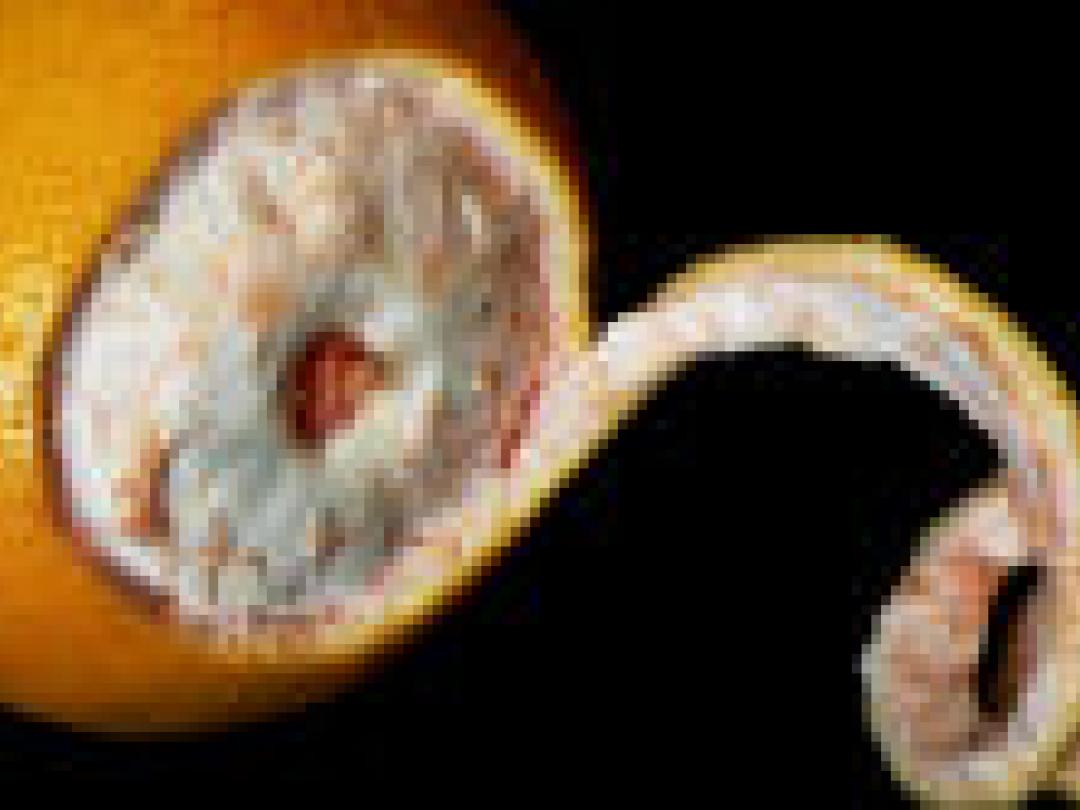 Brein vlakt af in adolescentie