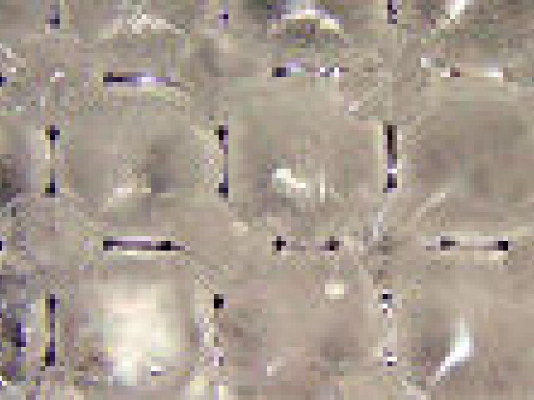 Koelen hoofdhuid tijdens chemotherapie tegen kaalheid kosteneffectief