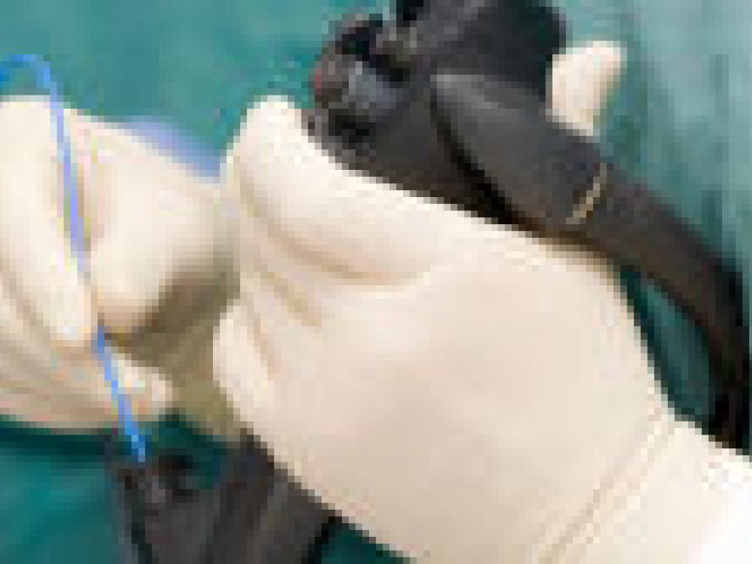 Vaardigheid chirurg gerelateerd aan uitkomst maagoperatie