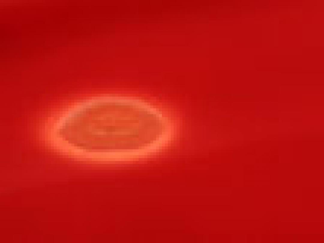 Selectieve decontaminatie verhoogt antibioticaresistentie niet