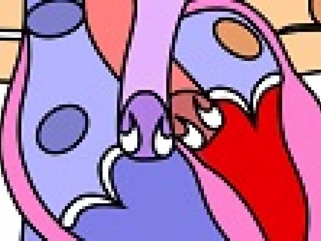 Incidentie trombose steunhart stijgt onverwacht