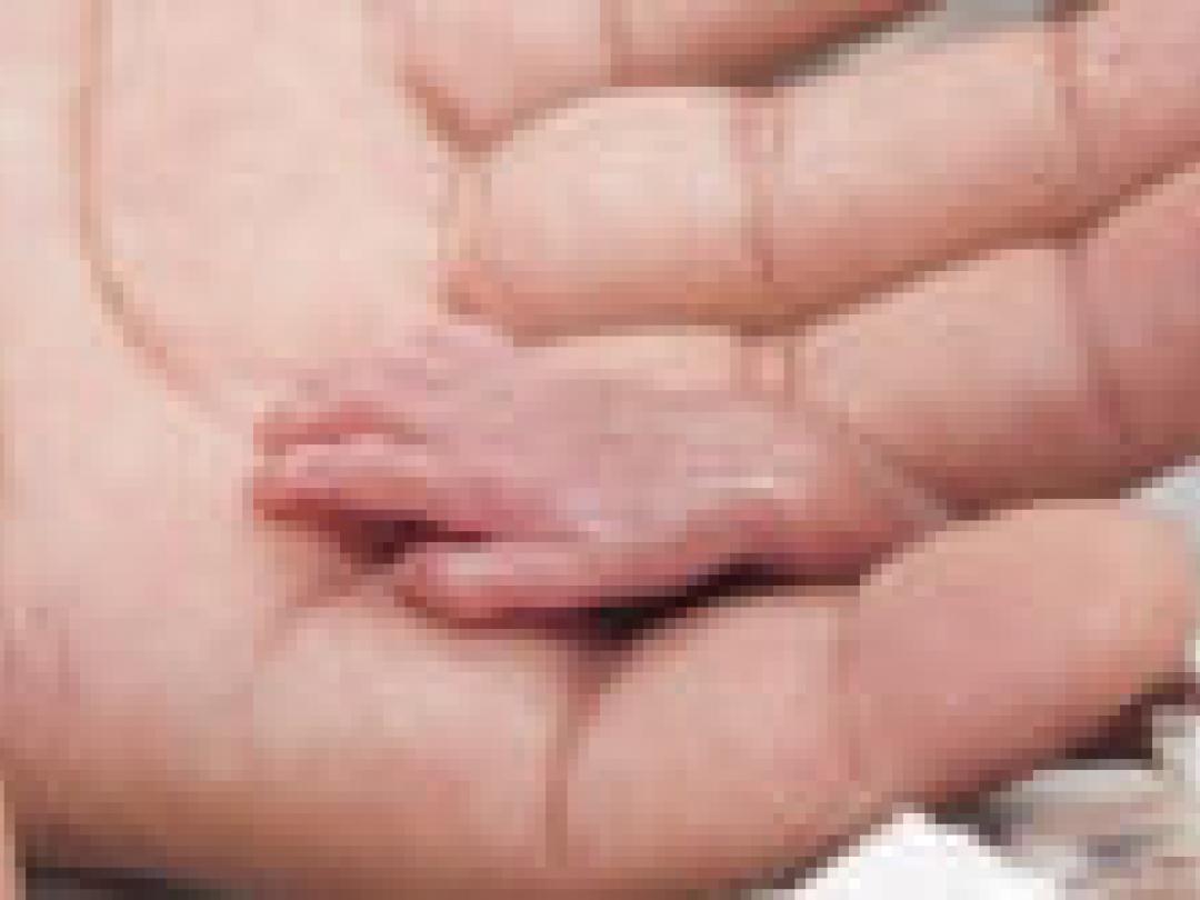 Neonatologen onder de loep met simulatiepatiënten