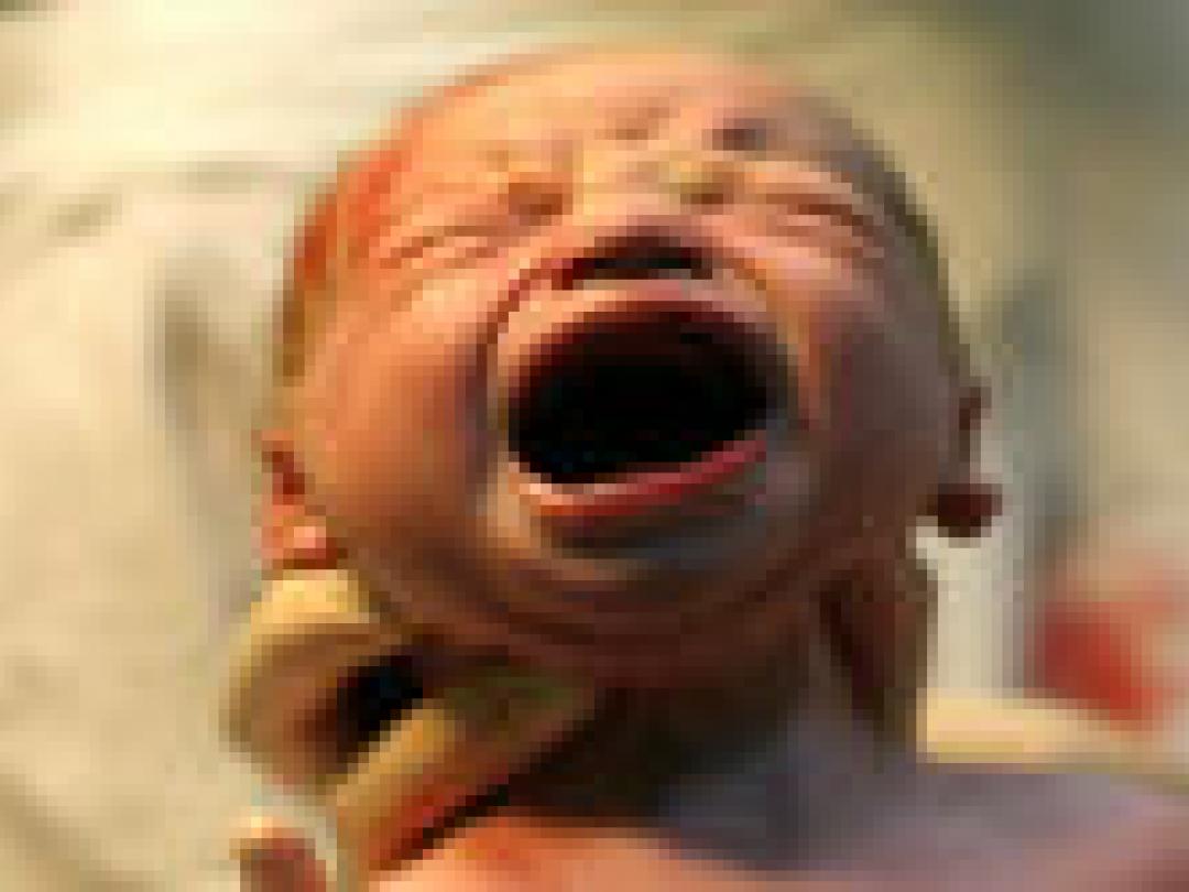 Spoed-sectio lijkt iets veiliger voor volgende zwangerschap dan geplande sectio