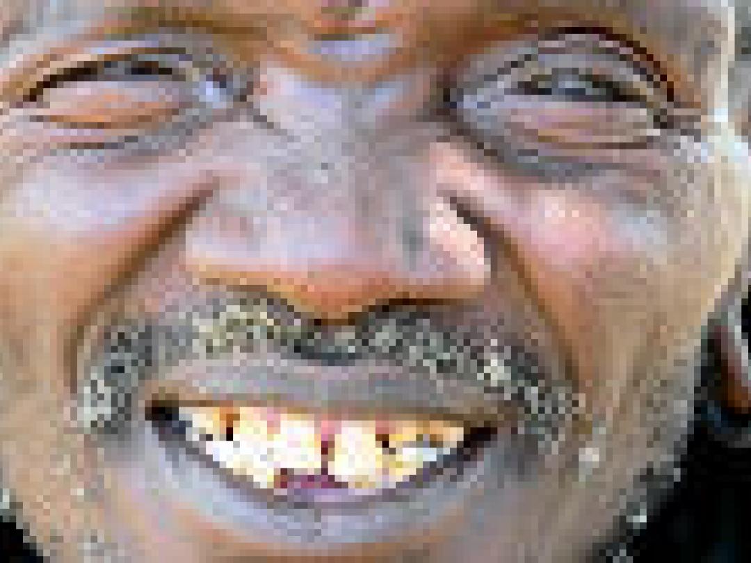 Micro-ziekenfonds kan bijdragen aan gezondheid in ontwikkelingslanden