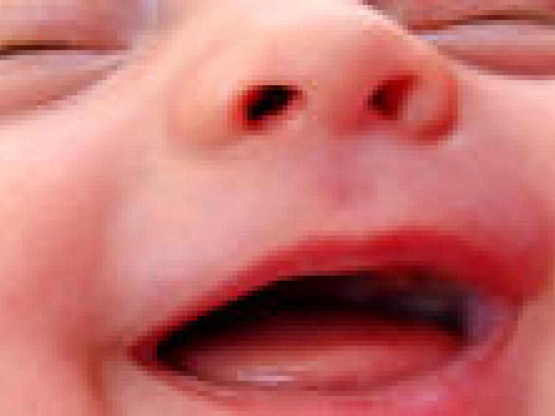 Verloskundige bevalling bij zwangere met obesitas kan veilig zijn