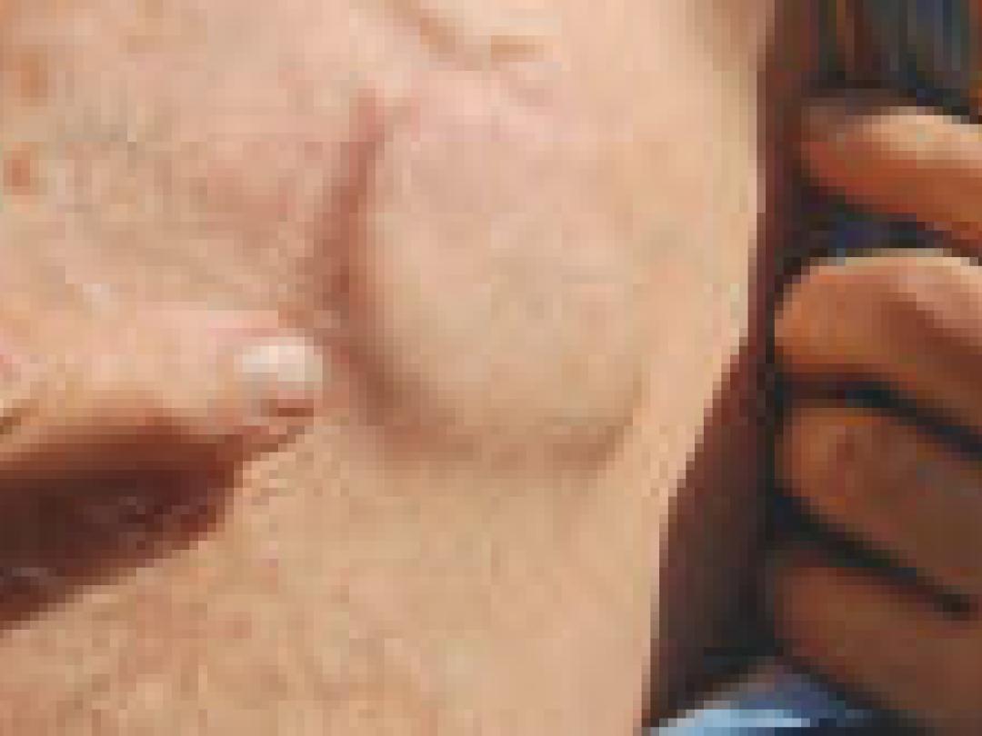 Observationele studies mogelijk te optimistisch over effecten ICD’s bij ouderen