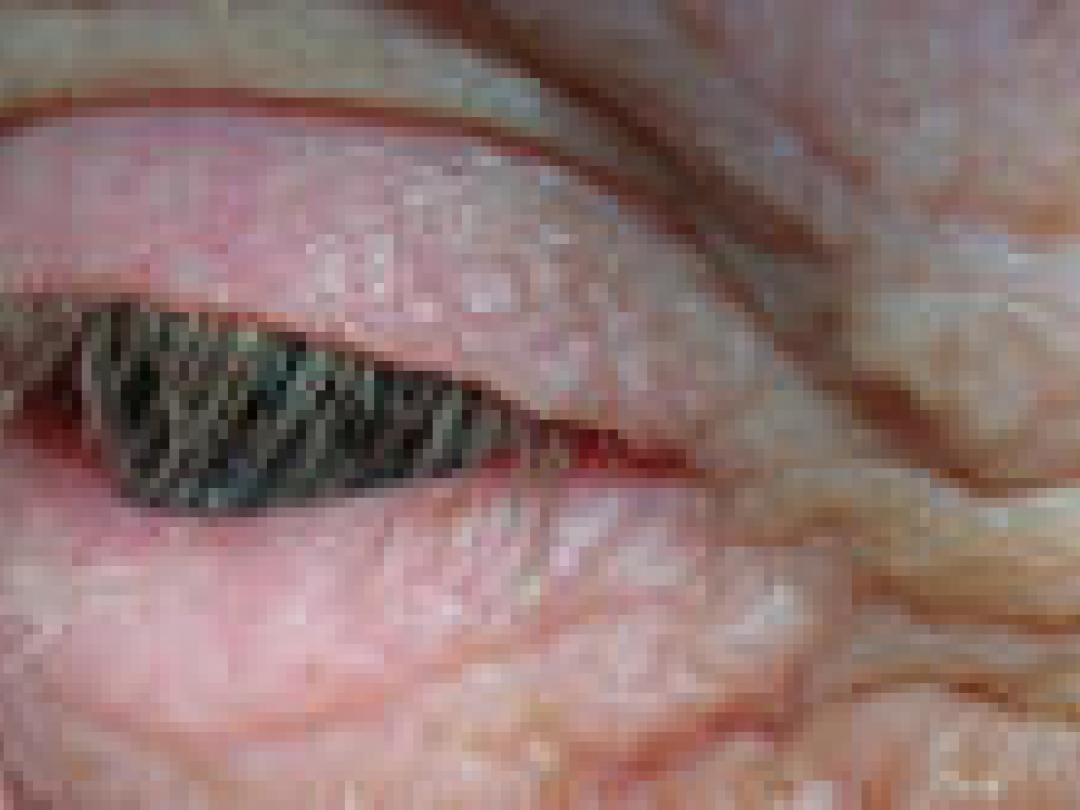 Nieuwe marker voor netvliesveroudering