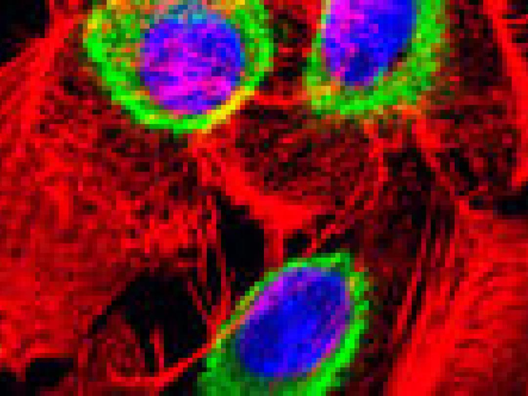 Methotrexaat bij darmkanker