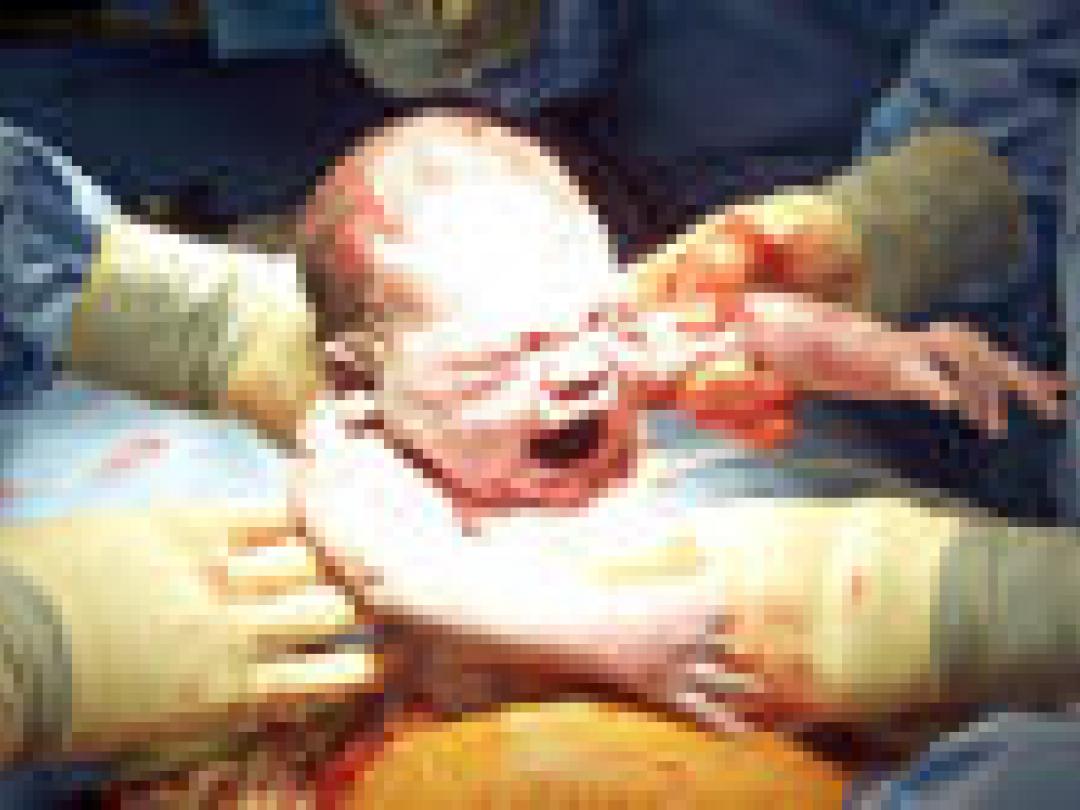 Grote obstetrische bloedingen rond bevalling