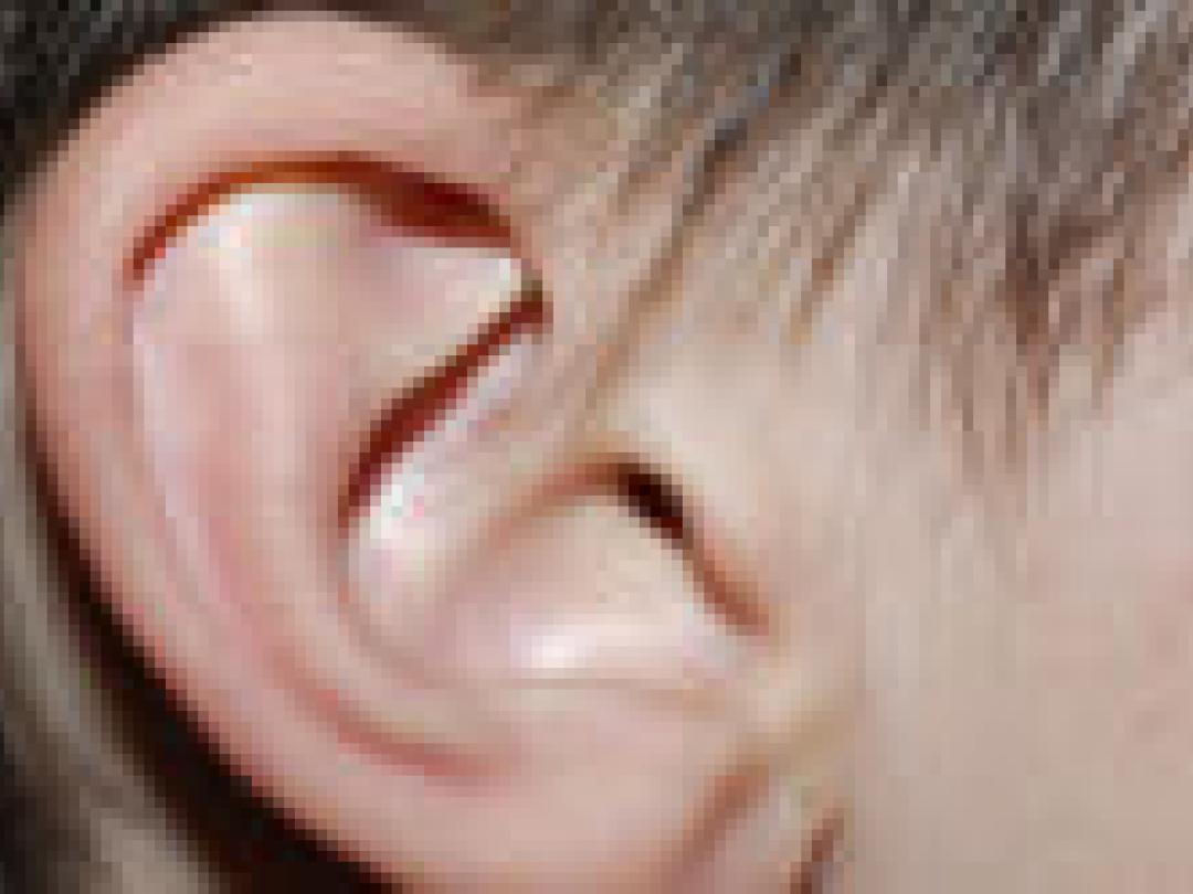 Complicaties en spraakcontrole na cochleair implantaat
