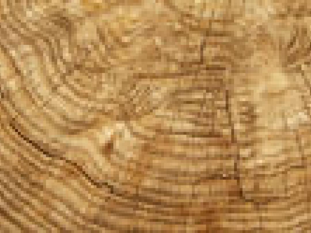 Automatische bepaling van botleeftijd