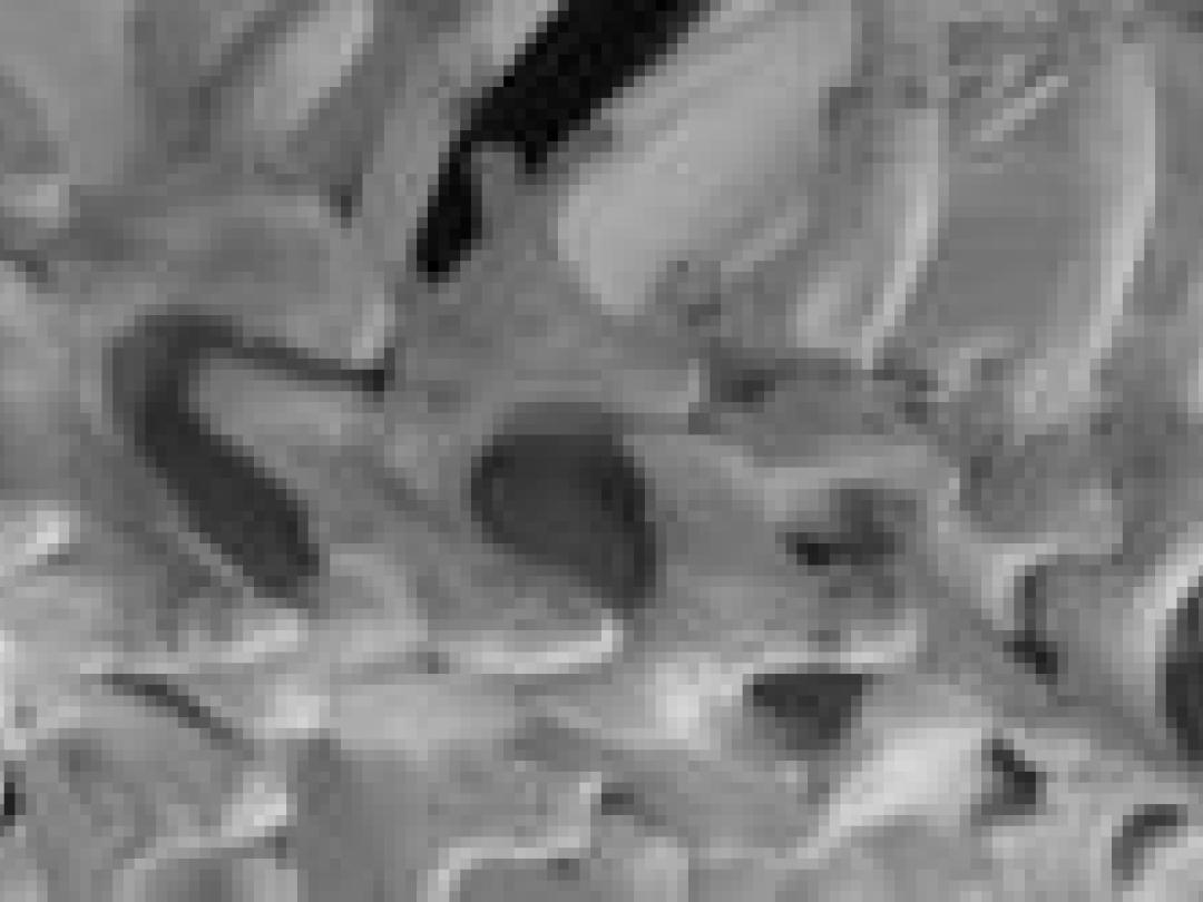 Osteoporosecheck in Brabant