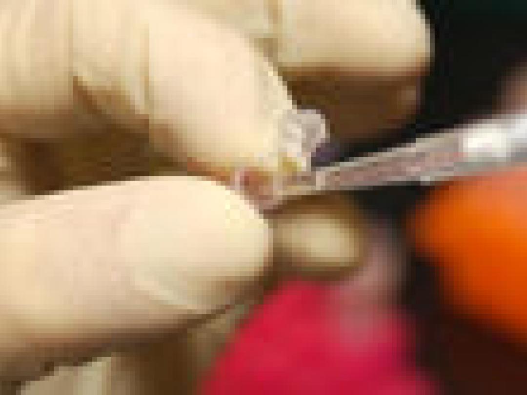 Twijfel over genetisch profiel cardiovasculair risico