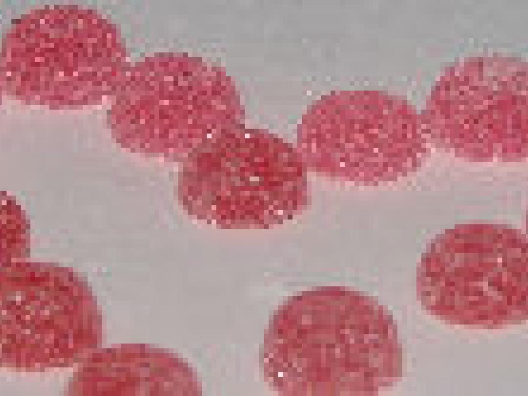 Causaal verband suikerziekte en atriumfibrilleren?