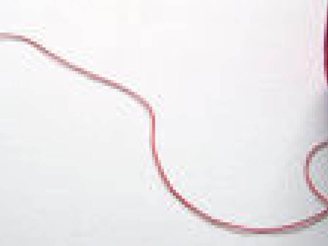 Dialysetijd is levenstijd