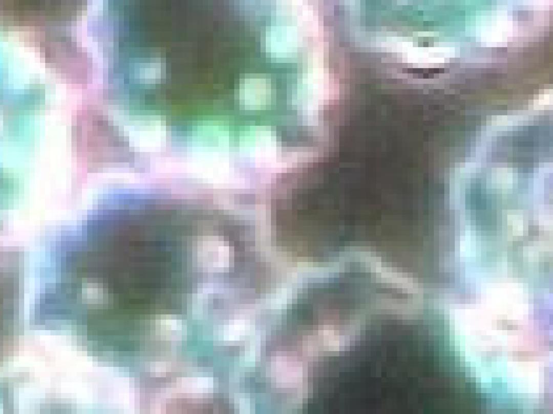 ‘Point-of-care’-tests chlamydia niet betrouwbaar