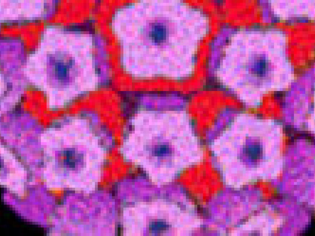 HPV18 niet voorspellend voor cervixproblemen