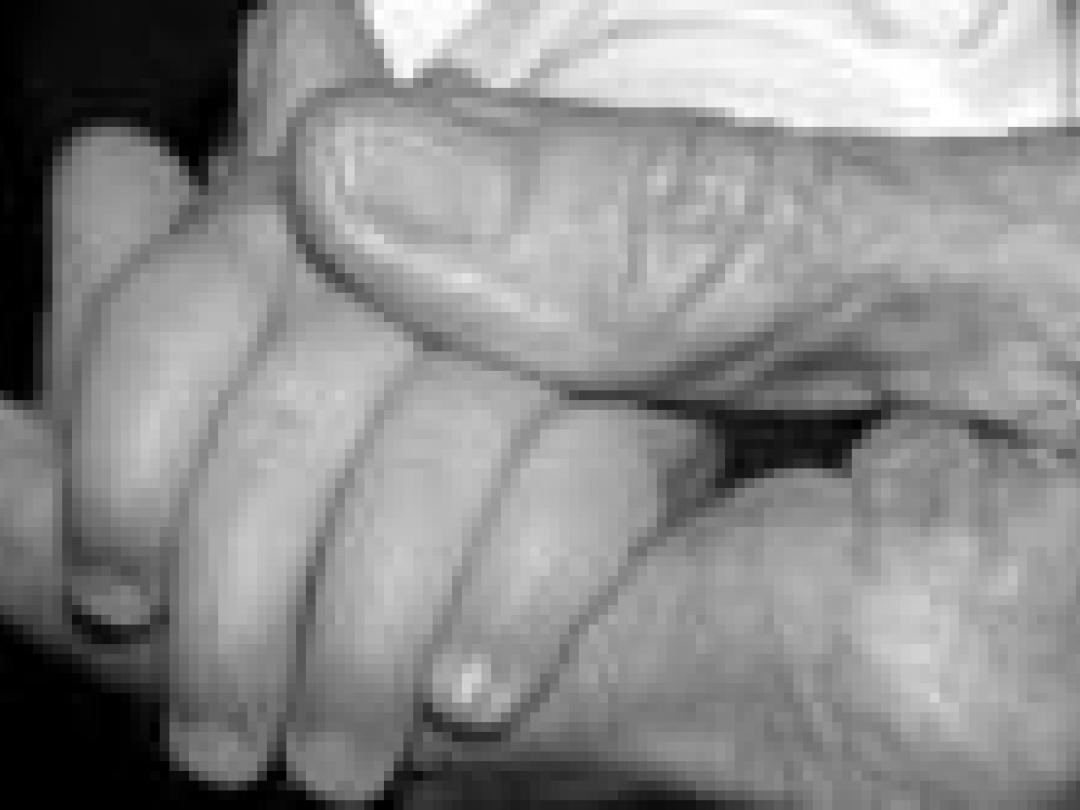 ‘Handenarbeid’ helpt tegen dementie