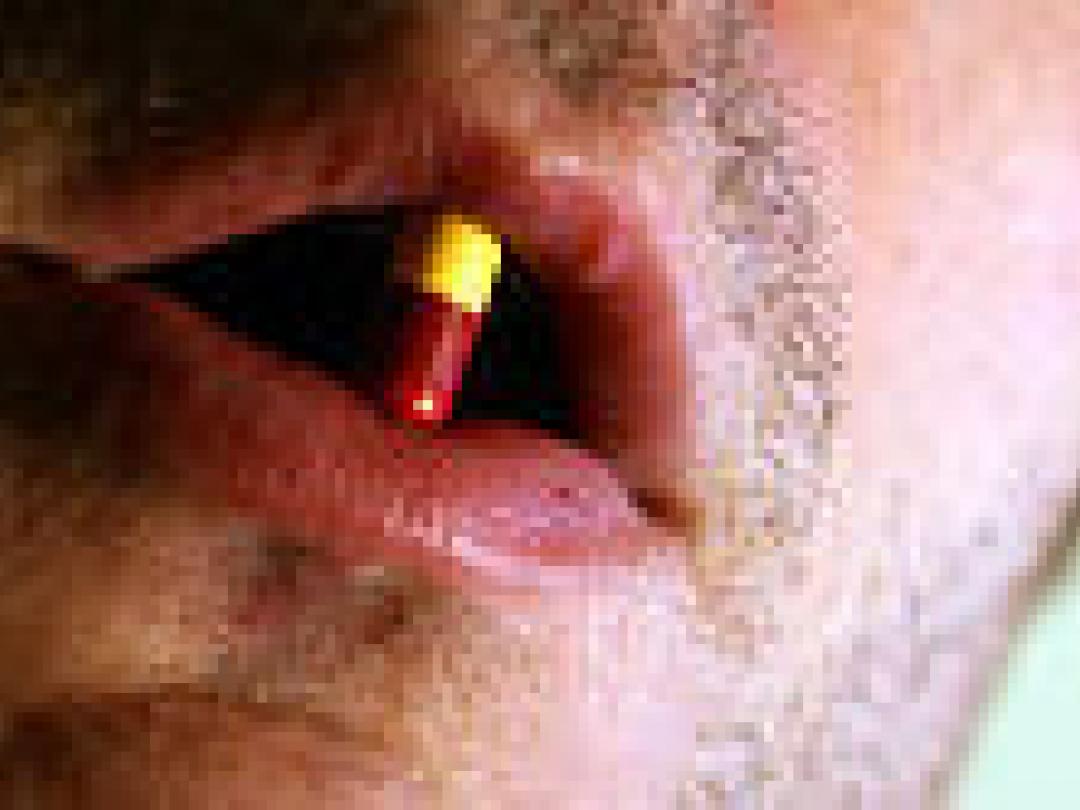 Geen goed bewijs voor nut antipsychotica bij gedragsproblemen