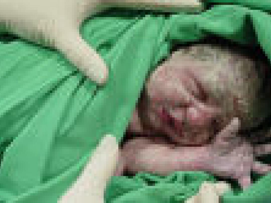 Braziliaanse damesbladen onderbelichten gevaren van sectio